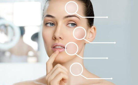 3. By Brand - Others