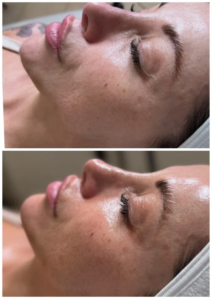DMCell - Peeling (Korean Glass Skin) - Lami Peel (PHA+LHA+AHA) Reconstruction - 라미필