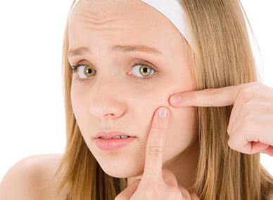 All Products: Acne & Hyperpigmentation