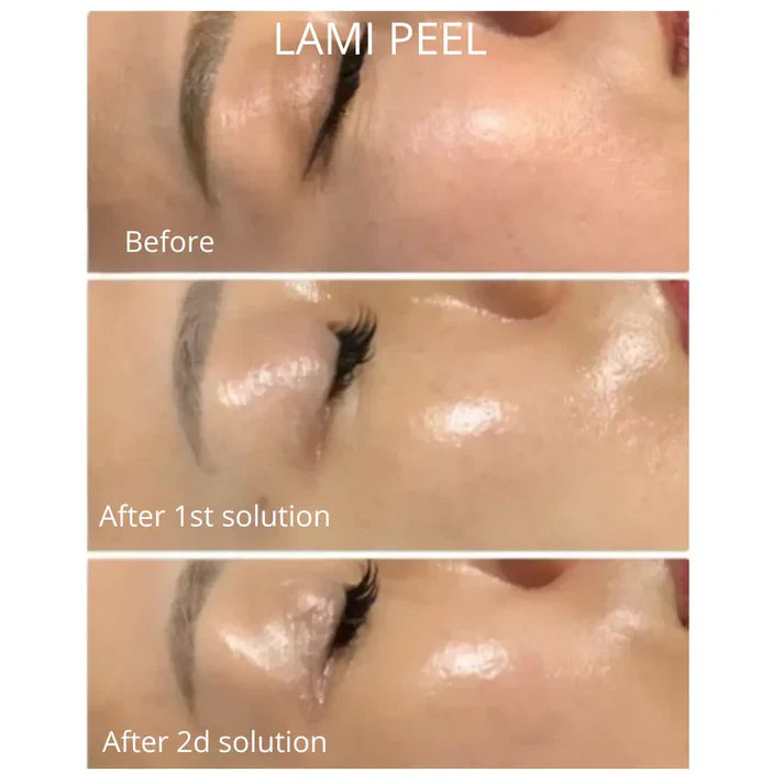 DM Cell - Peeling (Korean Glass Skin) - LAMI Peel (PHA+LHA+AHA